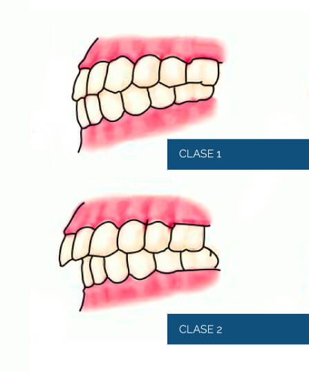 ortodoncia-1